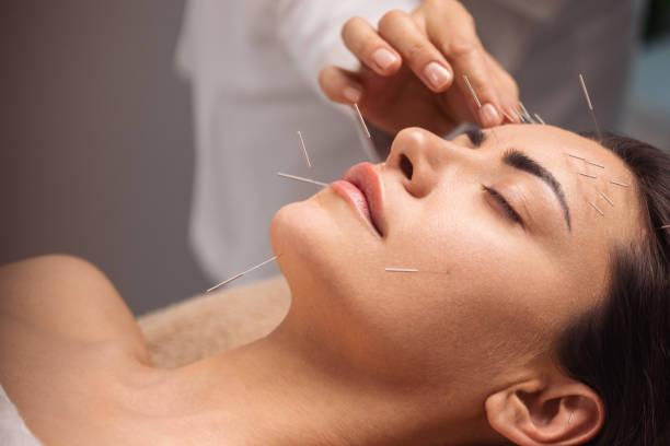 Facts Everyone Should Know About City Acupuncture.