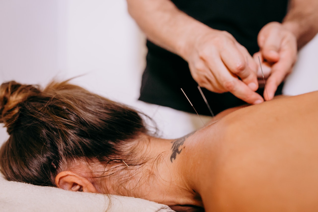 Awesome Reasons Why You Should Undertake Acupuncture