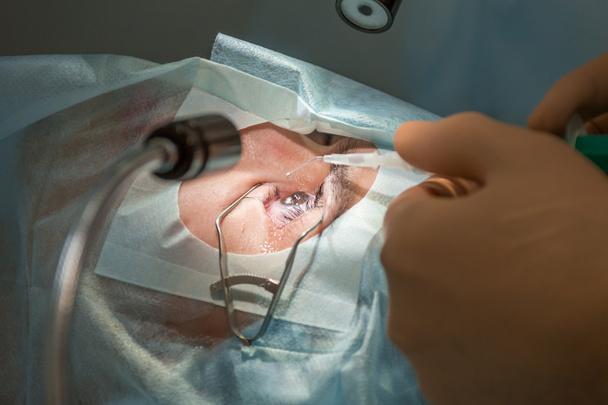 LASIK Surgeons in New York City: Transforming Vision with Expertise